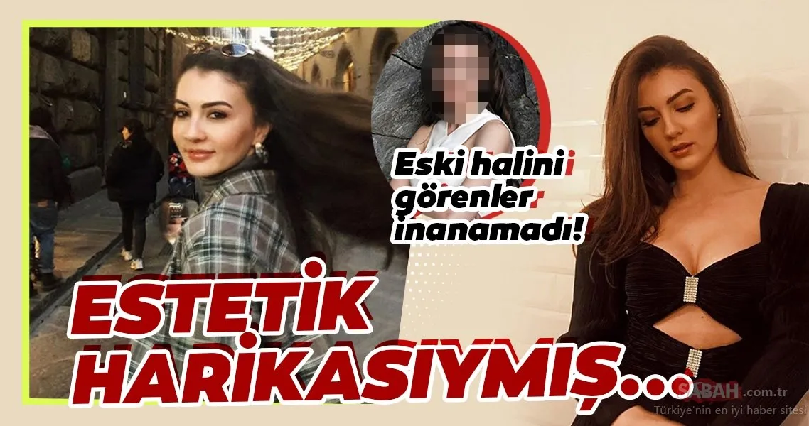 Afilli Aşk�ın Ayşe�si Burcu Özberk estetik harikası çıktı! Afilli Aşk
