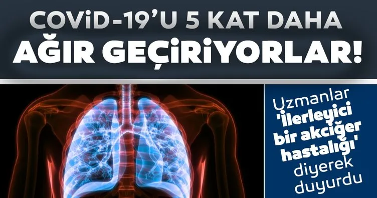 Uzmanlar ’İlerleyici bir akciğer hastalığı’ diyerek duyurdu: Covid-19’u 5 kat daha ağır geçiriyorlar