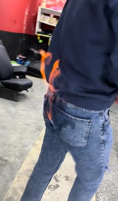 TikTok videosu uğruna yandı: Pantolonuna kolonya döküp çakmağı yakınca olanlar oldu