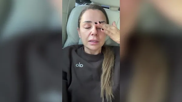 gozleri-dolu-dolu-anlatti-merve-ozbey-merdivenden-dustu-apar-topar-hastaneye-kaldirildi-1791183474267.jpg