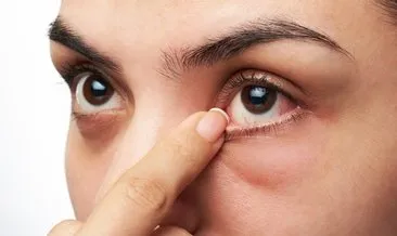 Göz sağlığınızı korumak için doğru beslenin