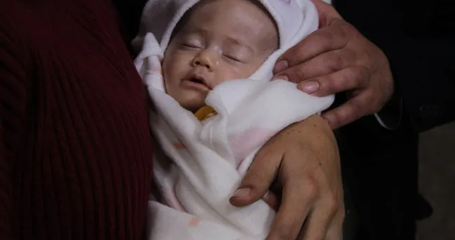 beyin dokusu olmadan dunyaya geldi