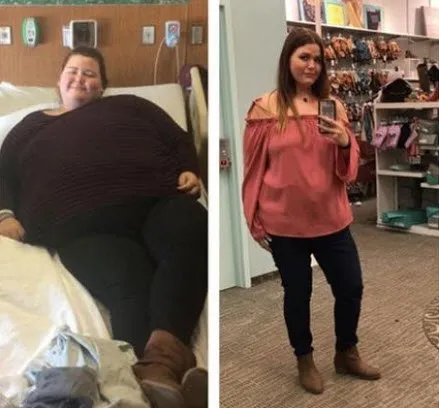 100 kilo verdi şimdi görenler güzelliğine hayran kalıyor!