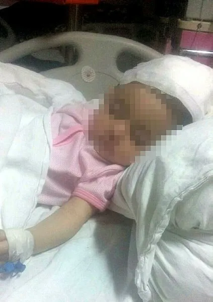 İzmir’de 9 aylık bebeğin başına, ablasının fırlattığı çatal saplandı