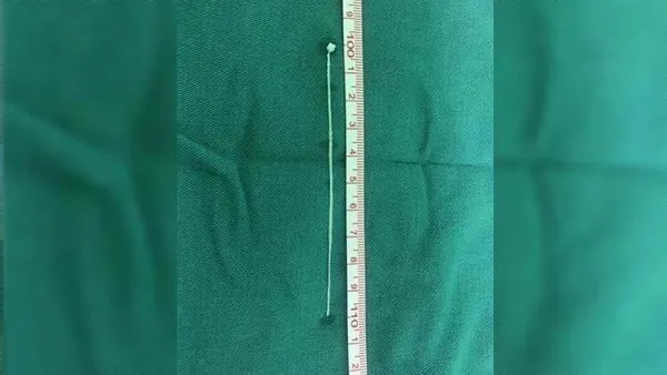 30 yıl boyunca baş ağrısı çeken adamın yaşadıkları kan dondurdu!