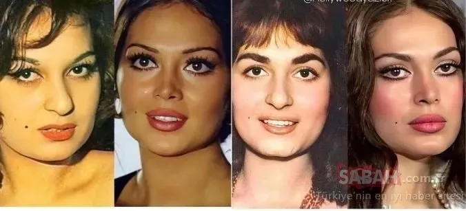 Yeşilçam’ın efsane güzellerinden biriydi! Estetiksiz halini tanıyabildiniz mi?
