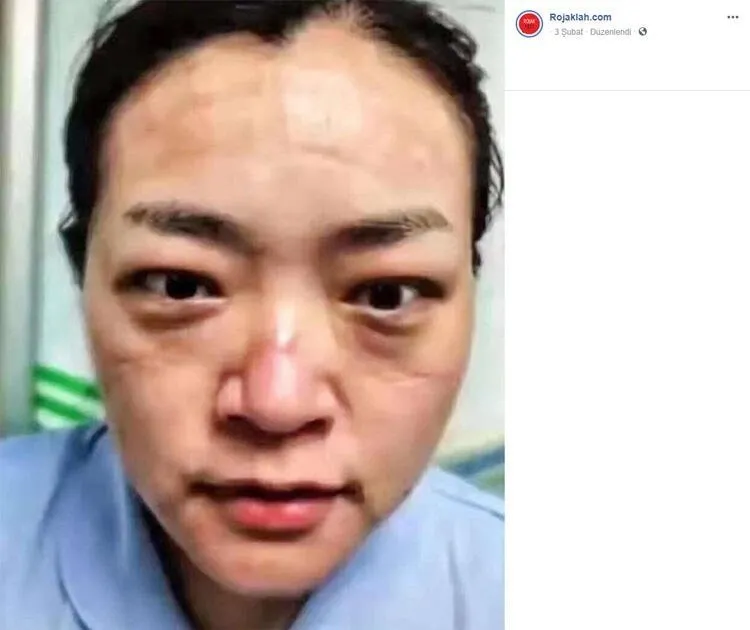 Koronavirüs ile mücadelenin izleri günlerce konuşulmuştu! Acı haberi duyurdular