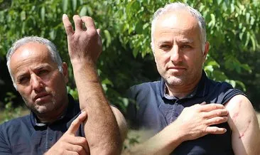 20 yıl sonra babasıyla aynı kabusu yaşadı: Tek gözünü çıkarmıştı, şimdi çocuklar tuvalete bile gidemiyor! #bolu