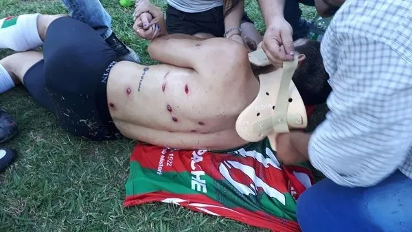 Futbolculara plastik mermi sıktılar!
