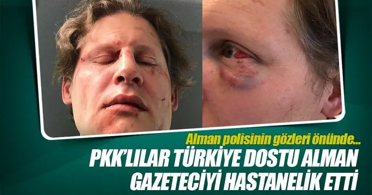 PKK’lılar Türkiye dostu Alman gazeteciyi hastanelik etti