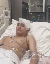 Akran şiddeti komalık etti