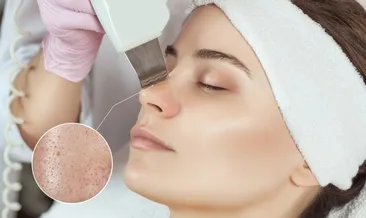 Göz çevresindeki yağ bezelerine dikkat !