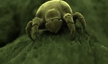Bu canlılar yüzümüzde yaşıyor! Gözle görülmeyen böceklerin ortaya çıkmasının asıl sebebi...